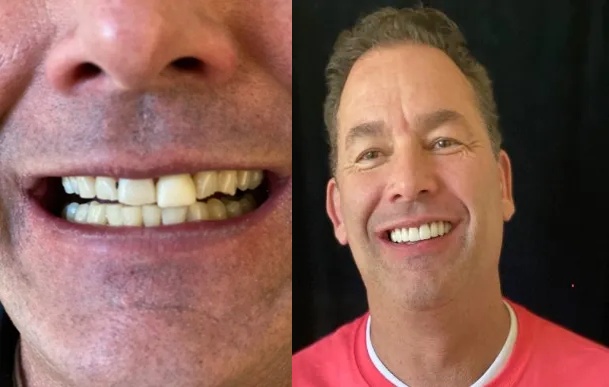 Bosler Implant & Cosmetic Dentistry Image