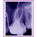 Pinole Endodontics Logo