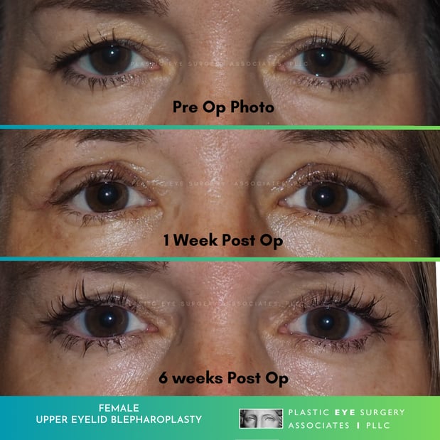 Images Plastic Eye Surgery Associates, PLLC