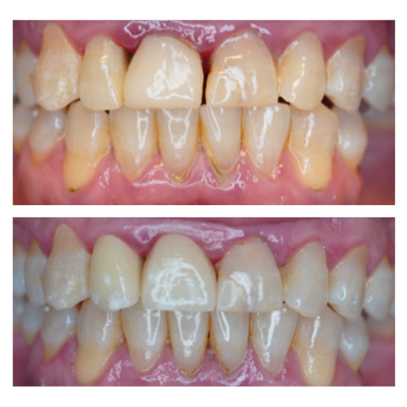 Cortes Family Dentistry- Ortodoncia