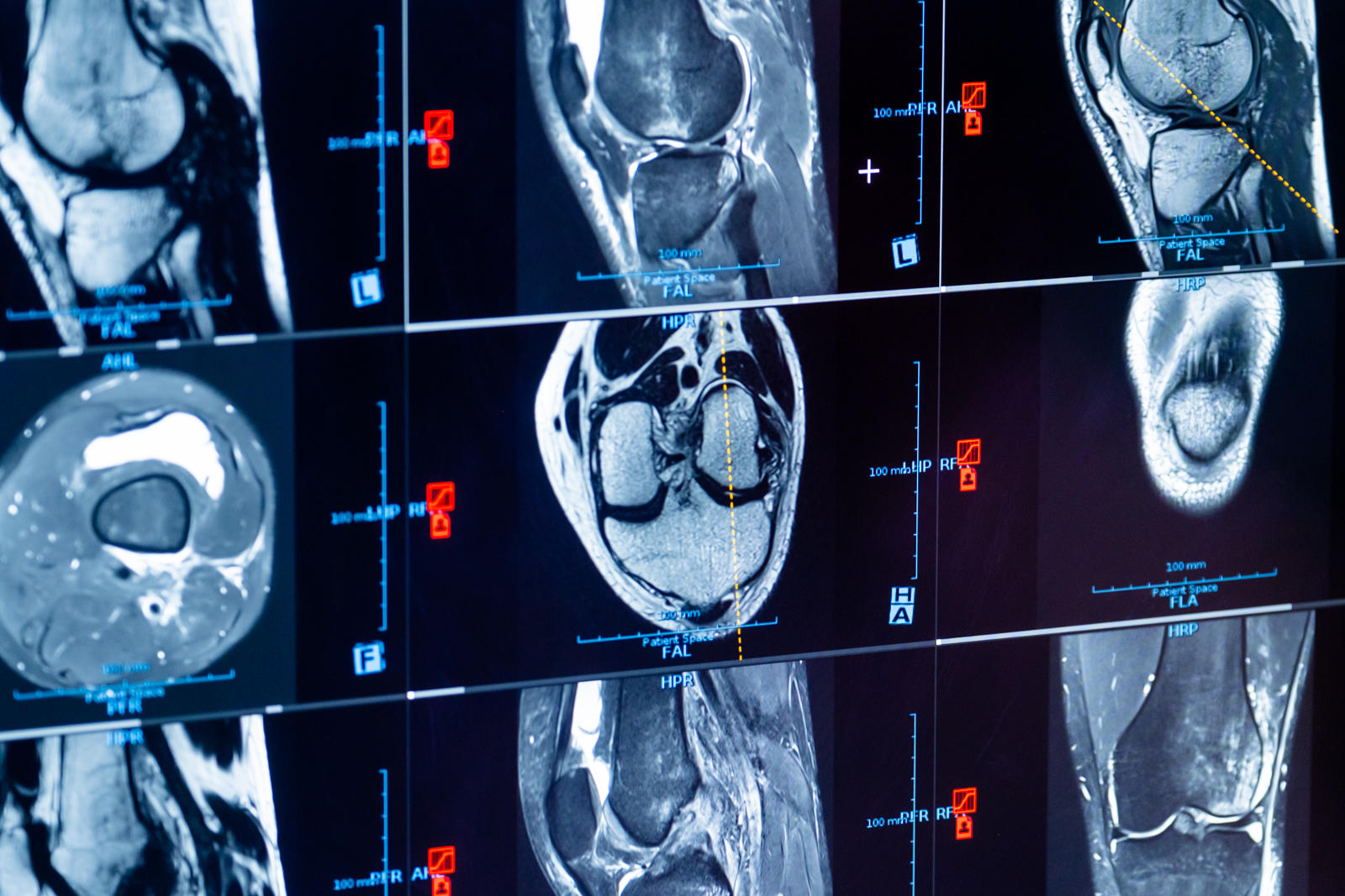 Bild 12 Dr. Lins | Ihre MRT Radiologie Privatpraxis Stuttgart | Schnelle Termine Vorsorge und mehr in Stuttgart