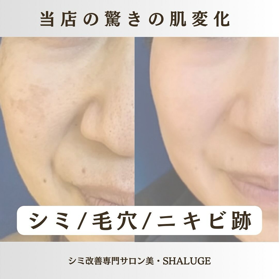 Images 美・SHALUGE