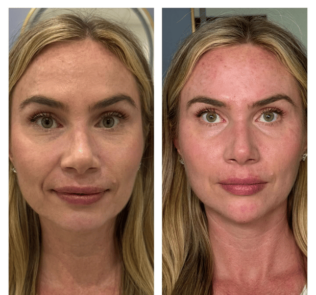 Images ReNu Self Medical