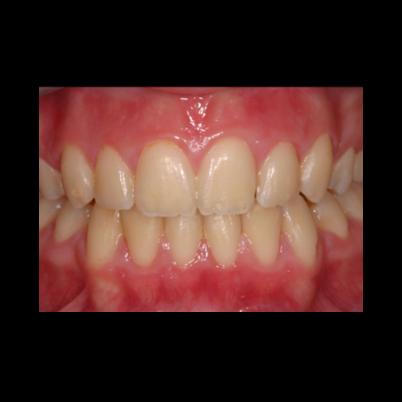 Fotos - Studio Odontoiatrico Ortodontico Dott. Massimo Piccione - 3