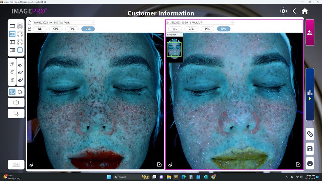 Emage Medical skin imaging system