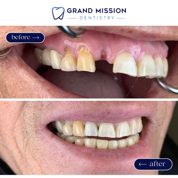 Images Grand Mission Dentistry Of Richmond