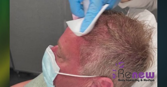 Images Renew Body Contouring & MedSpa