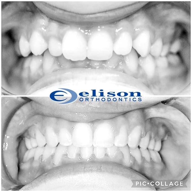 Images Elison Orthodontics South Jordan: Timothy B Elison