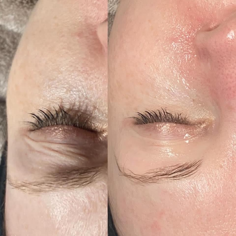 Images Cheshire Treatments