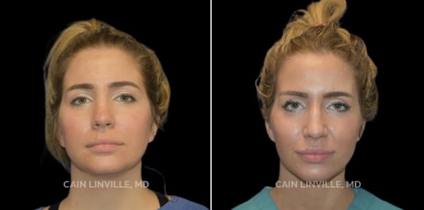 Images Linville Plastic Surgery