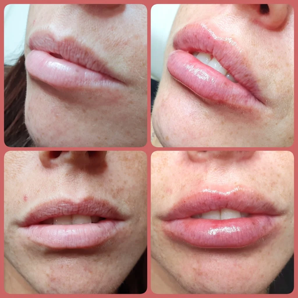 Images Lincoln Aesthetic