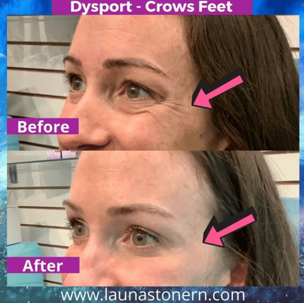 Images Launa Stone, R.N.