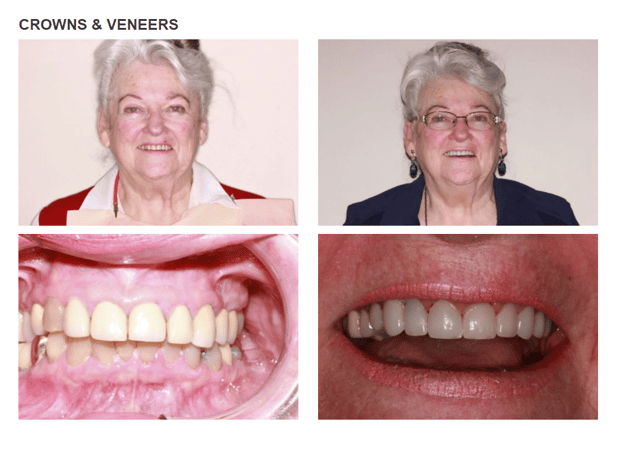 Images Roy Dental Care
