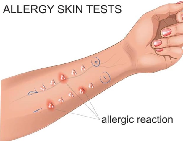 Images Gupta Allergy: Allergy & Asthma Specialists of Lansing, PLLC