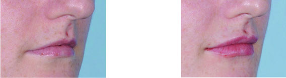 Dr. Marlene Kachelmaier - Ordination für Ästhetische Medizin, Halsweg 11 in Trofaiach