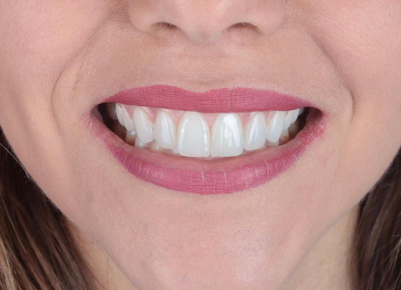 Images Centro Odontoiatrico Aufiero Dr. Giovanni