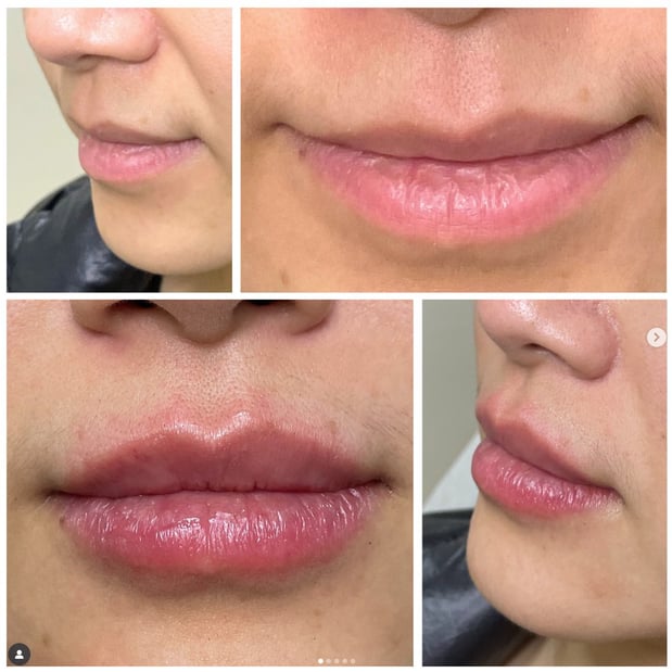 Images Better Med Spa & Wellness