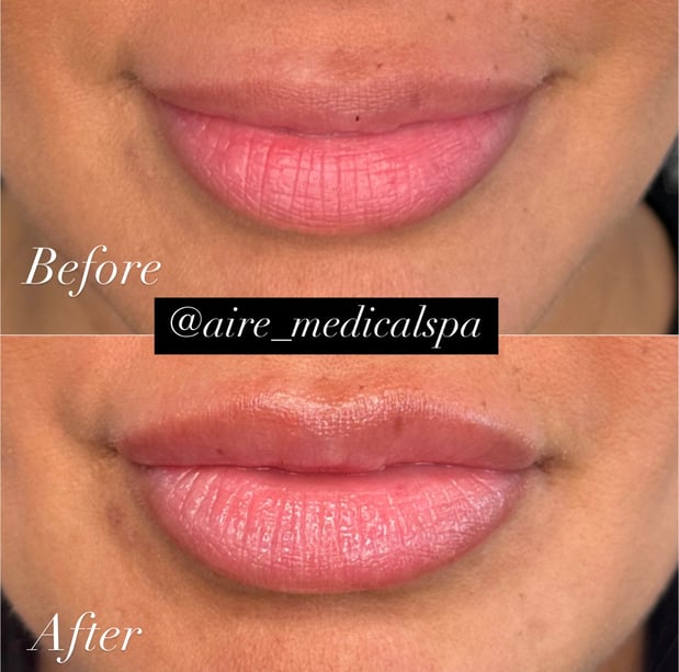 Images Aire Medical Spa