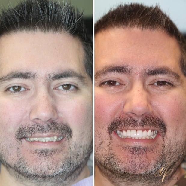 Images Almeida & Bell Dental Lone Tree - General, Cosmetic, and Implant Dentistry