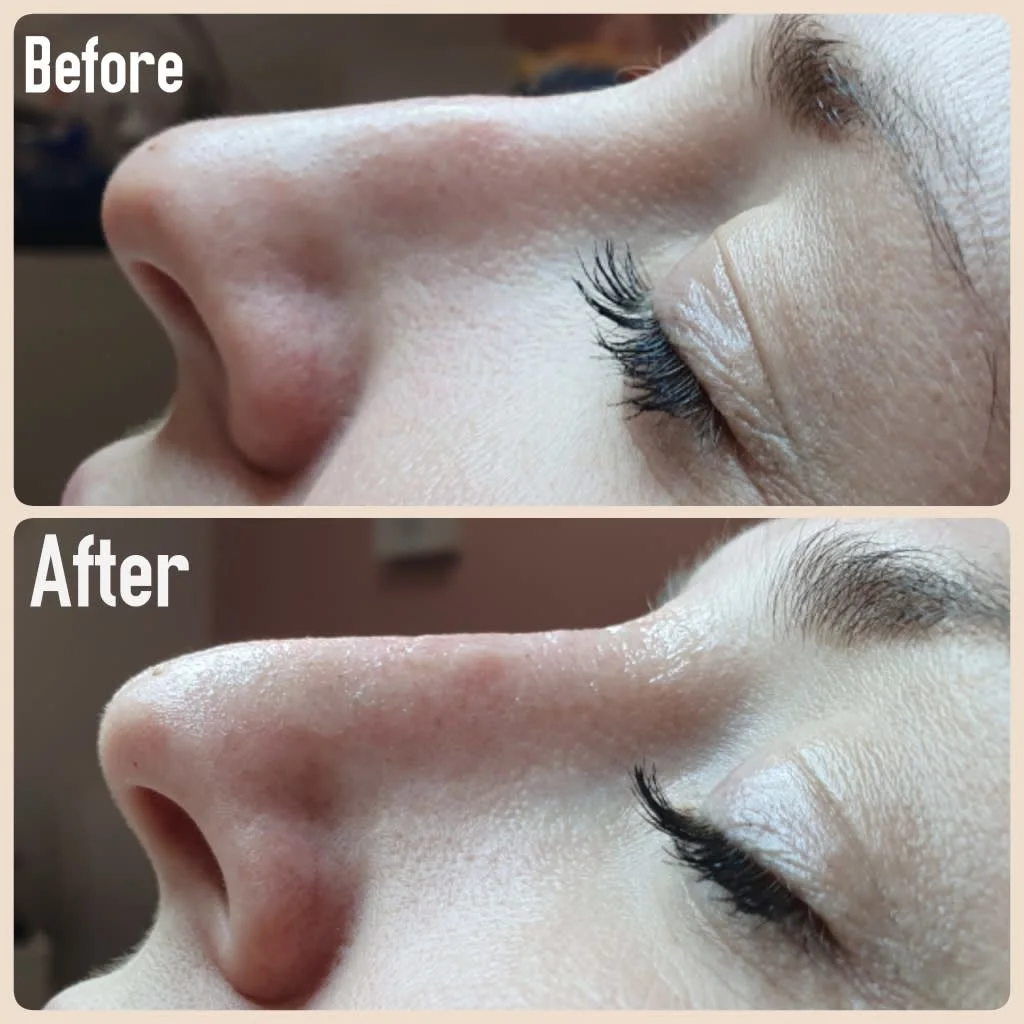 Images Lincoln Aesthetic