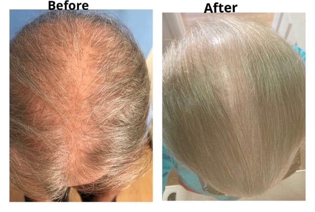 Images Dr. George Brennan - Cosmetic Surgeon Newport Beach