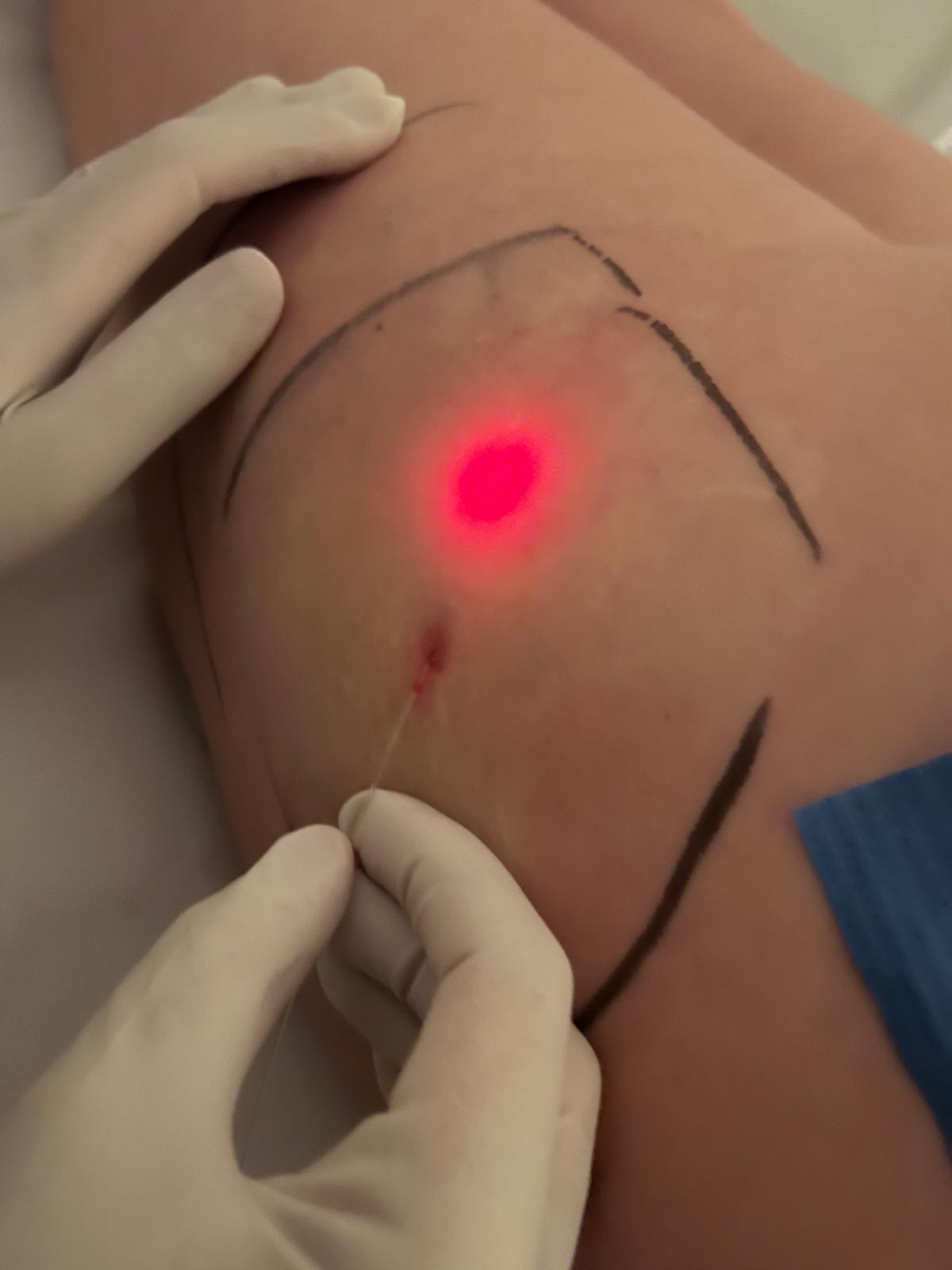 Images Ivamer Patricia Motos - Clínica Médico Estética