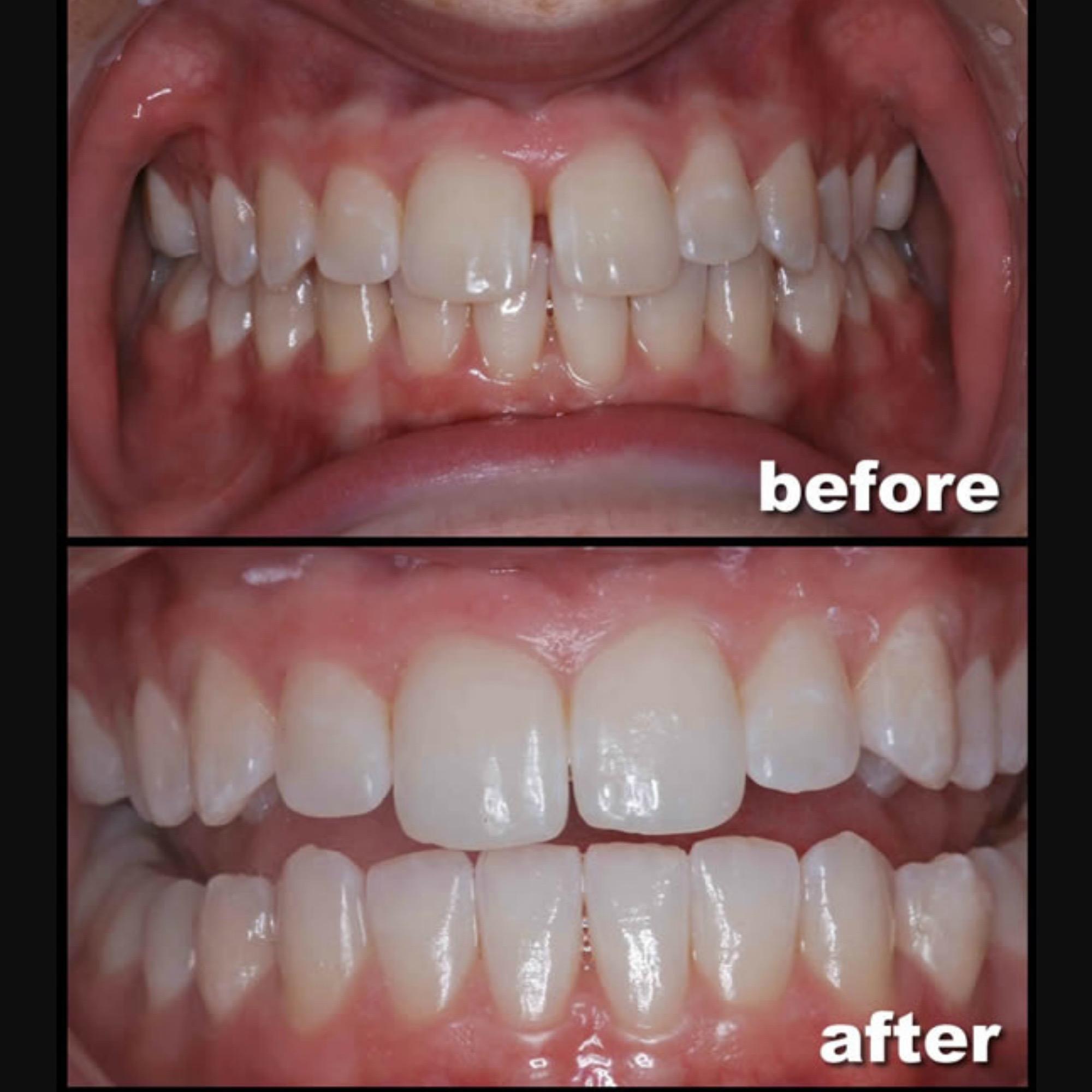 OrthoSnap New York Manhattan in New York, NY 10075