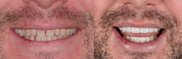 Images Hoopes Dental