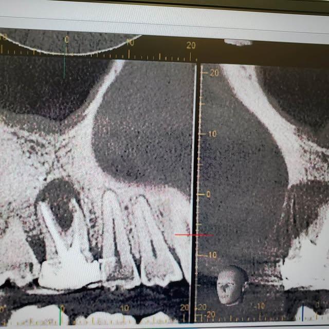 Images Smiles By Eddie: Dr. Edmond Ahdoot DDS