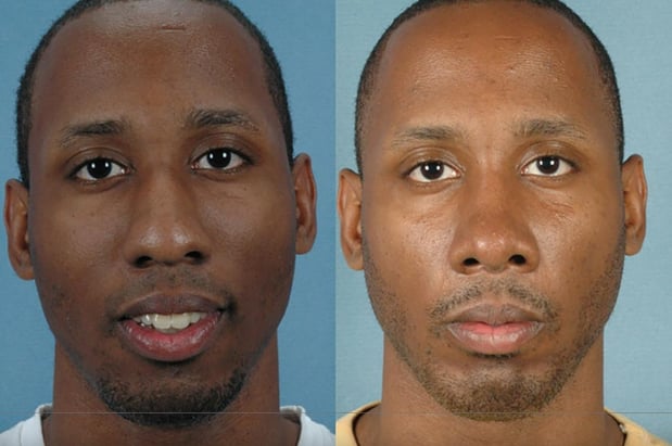 Images Rejuvenis Facial Cosmetic Surgery and Medical Spa