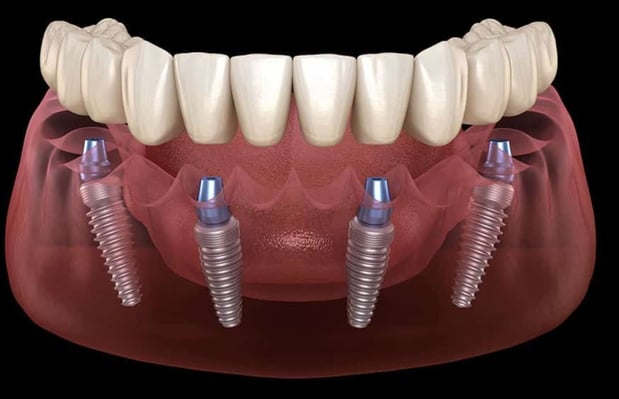 Images Coleman's Dental Studio
