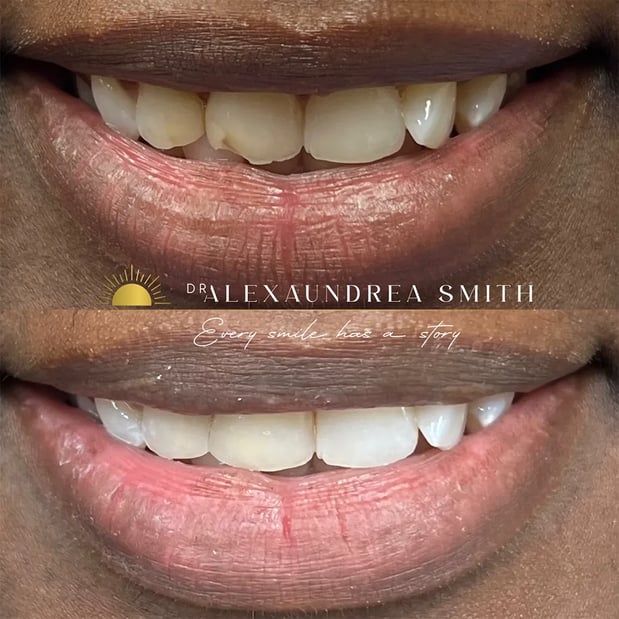 Images Overhill Dental