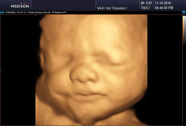 Images Heavenly 3D 4D Ultrasounds