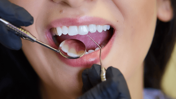 Images Harborside Dental Team