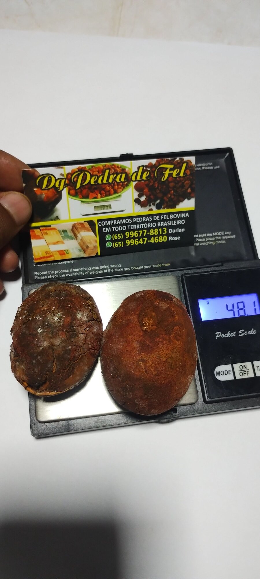 Images Dg pedras de fel bovinos