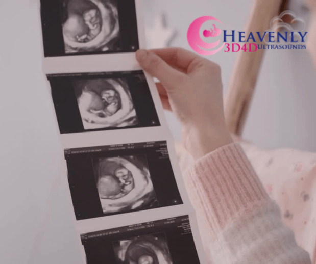 Images Heavenly 3D 4D Ultrasounds