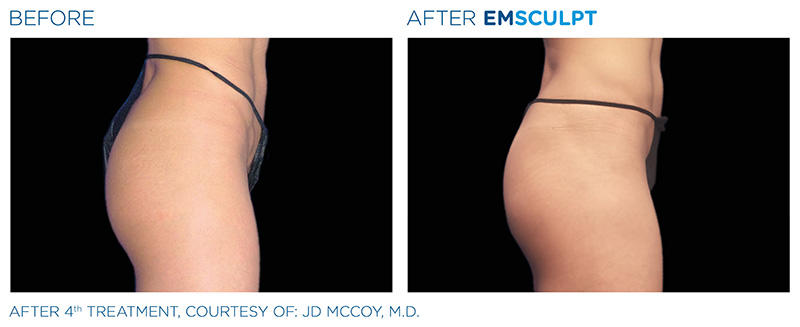 Slim Studio EMSCULPT & Coolsculpting Photo