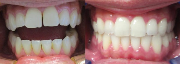 Images Premier Dental of South Orange County