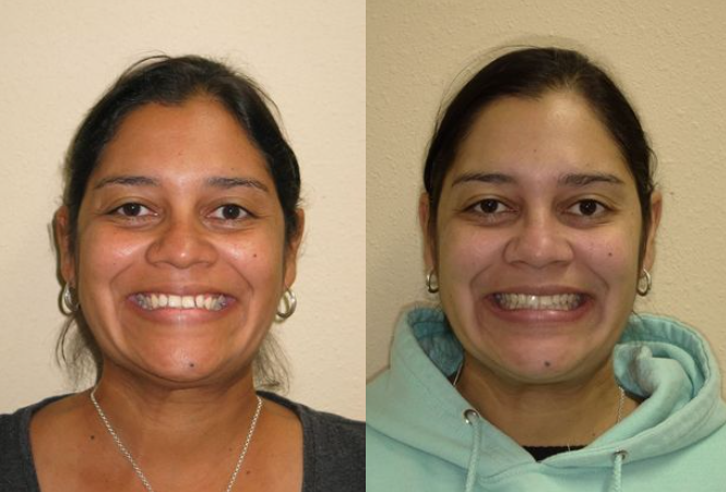 Images Hulme Orthodontics