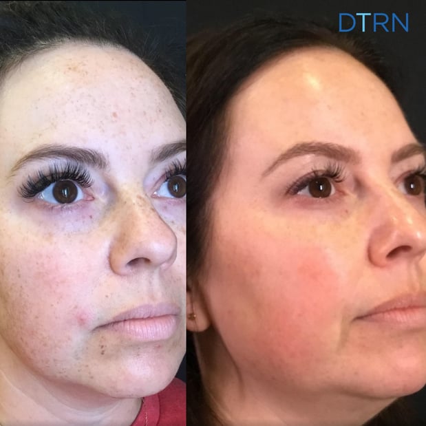 Images DermaTouch RN