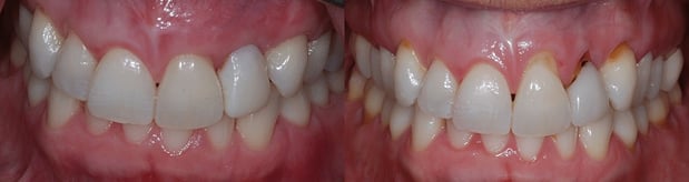 Images Mountainview Periodontics