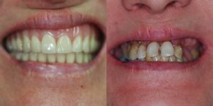 Images Haws Family Dentistry