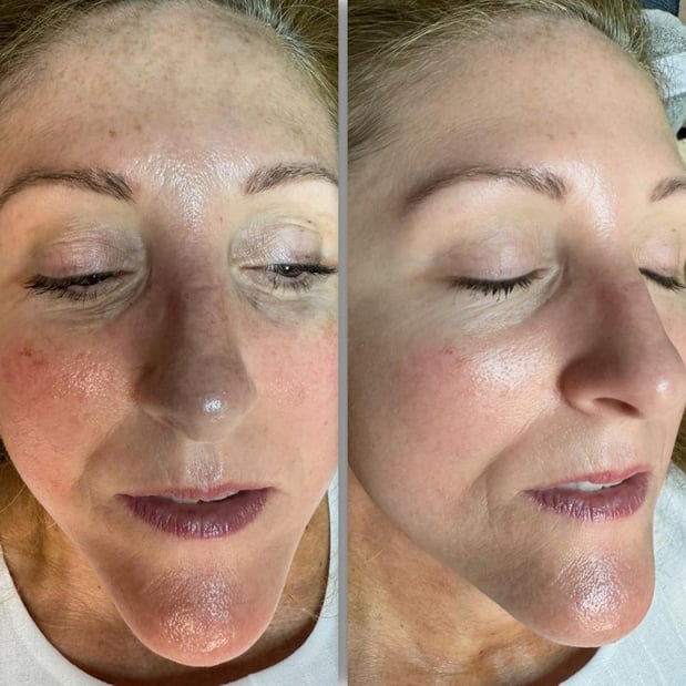 Images Permaskin Beauty Center & Academy