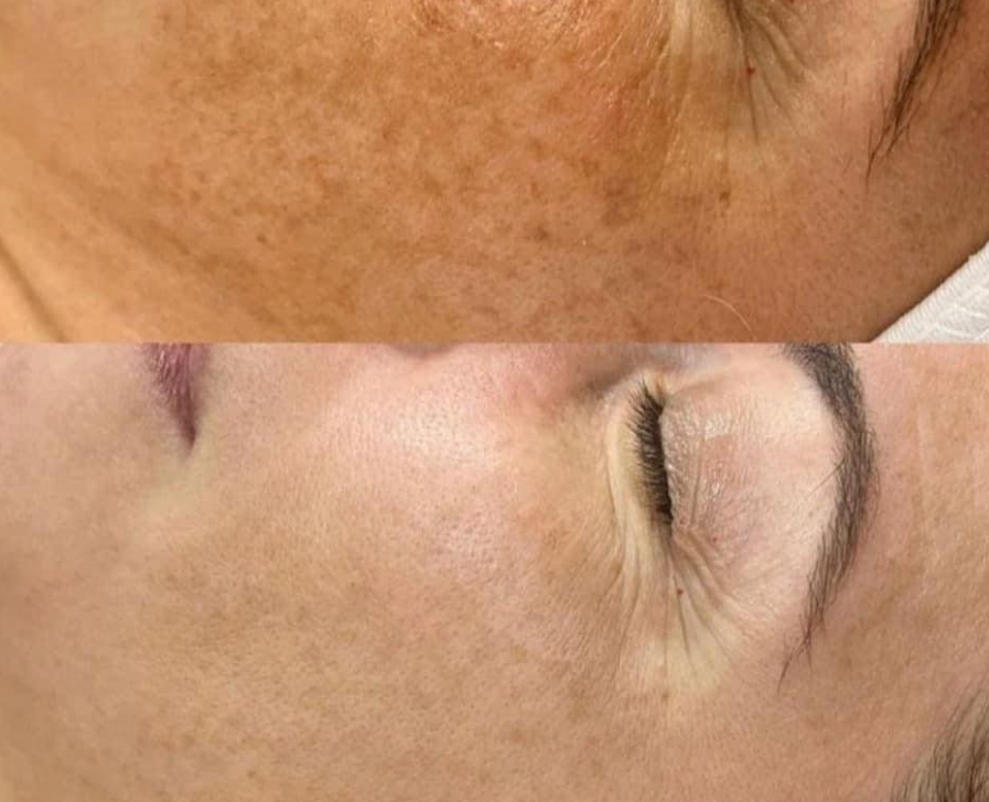 Images Clinique d'Esthétique Leila - Hydrafacial, Microblading, Épilation Laser Sainte-Foy