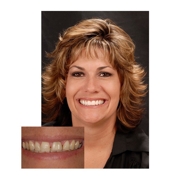 Images San Diego Smiles