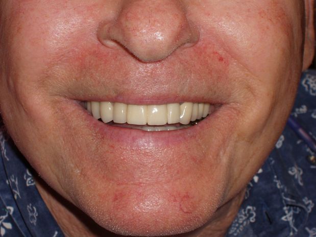 Images Aaron A. Leishman DMD, PA