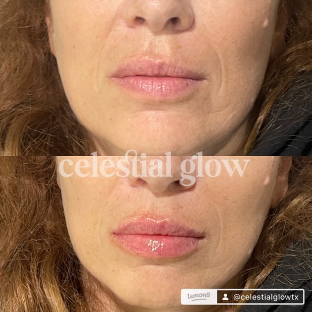 Images Celestial Glow Aesthetics Clinic