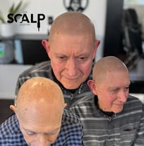 Images The Scalp Master