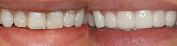 Images River Oak Dental