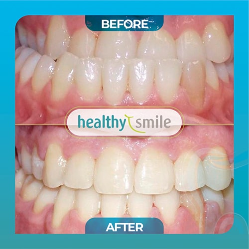 Healthy Smile / Implant & Cosmetic Dentistry Photo